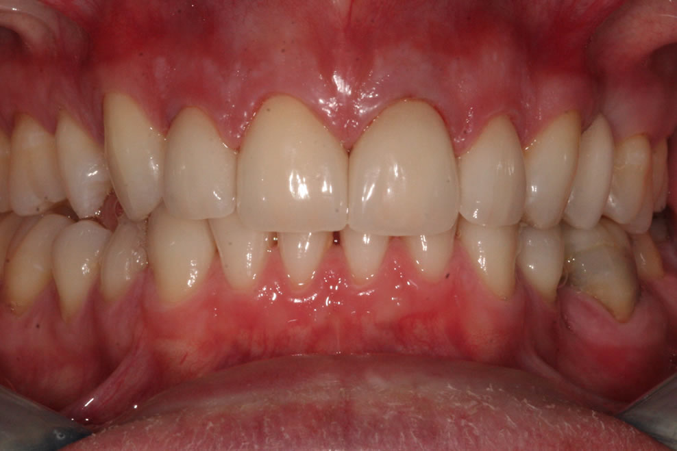 beautiful results from dental treatments