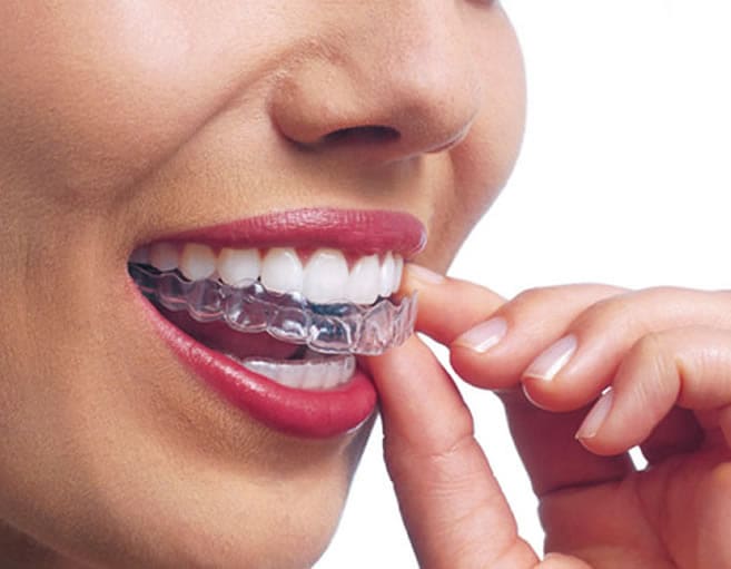 adult braces in ware